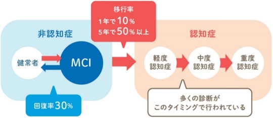 MCIの段階図